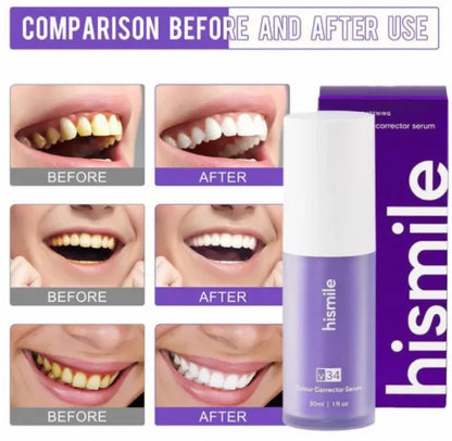 Hismile - Teeth Brightening Serum V34 (Original)