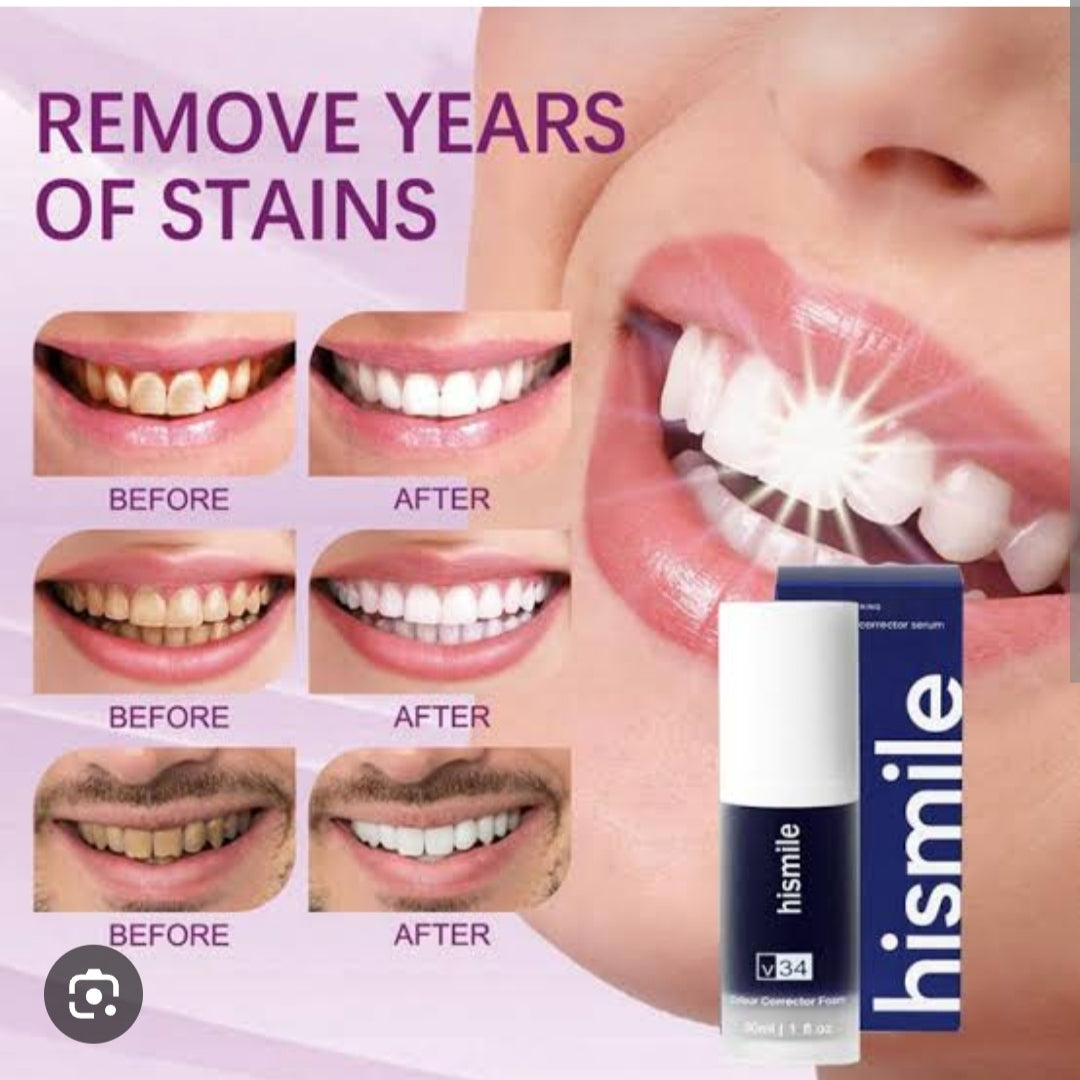 Hismile - Teeth Brightening Serum V34 (Original)